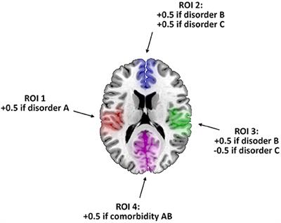 Focusing on Comorbidity—A Novel Meta-Analytic Approach and Protocol to Disentangle the Specific Neuroanatomy of Co-occurring Mental Disorders